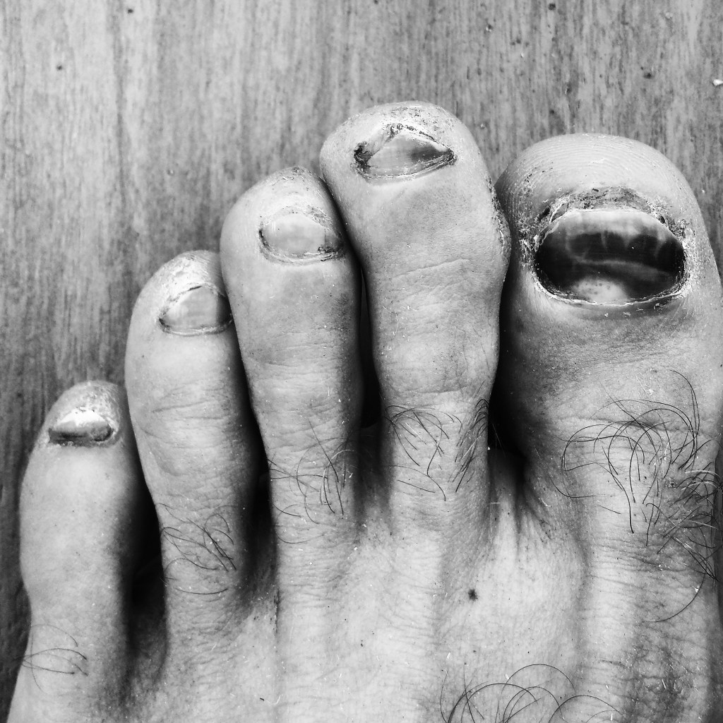 Looks worse than it is ... feet were great all day!!!